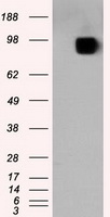 SARS-CoV-2 S Protein Mouse Monoclonal Antibody [Clone ID: OTI4C6]