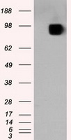 SARS-CoV-2 S Protein antibody