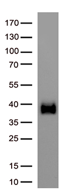 SARS-CoV-2 Spike Protein antibody