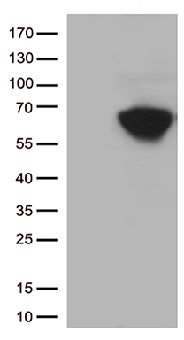 SARS-CoV-2 Spike Protein Antibody