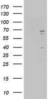 SARS-CoV-2 Spike Protein Antibody