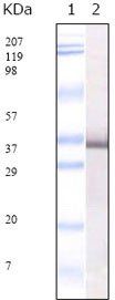 SARS-E2 Antibody