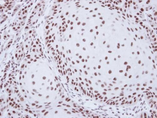 SART1 Rabbit Polyclonal Antibody