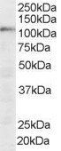 Goat anti-SART1 Antibody