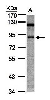 SART1 antibody