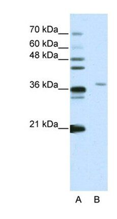 SART3 antibody