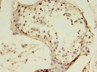 SART3 antibody