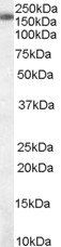 SART3 antibody