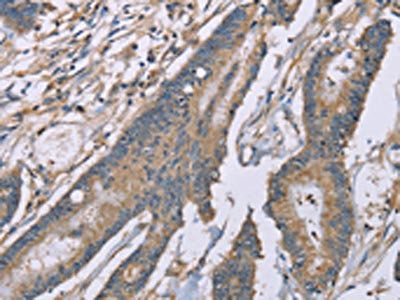 SASH1 Antibody