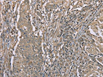 SASH1 Antibody