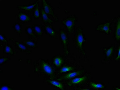SAT1 Antibody