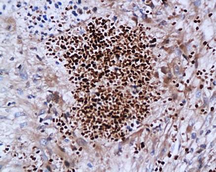SATB1 Rabbit Polyclonal Antibody