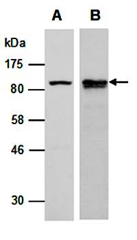 SATB1 (vPairTM) Antibodies