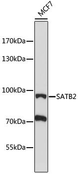 SATB2 antibody