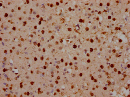 SATB2 Antibody