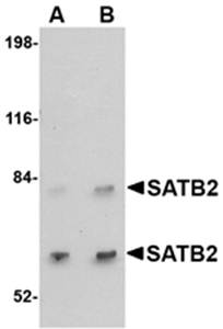 SATB2 Antibody