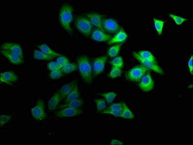 SBK2 Antibody
