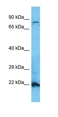 SC6A6 antibody
