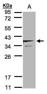 SCAMP3 Rabbit Polyclonal Antibody