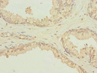 SCAND1 Antibody
