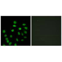 SCAND1 Antibody