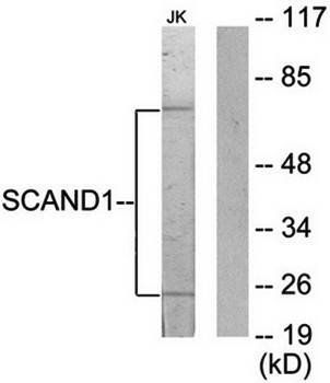 SCAND1 Antibody