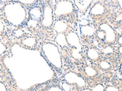 SCAP Antibody