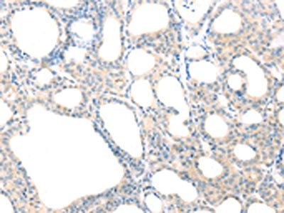 SCAP antibody