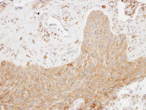 SCAP2 Rabbit Polyclonal Antibody