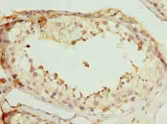 SCAPER Antibody
