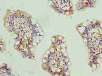 SCARA3 Antibody