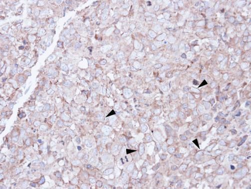 SCARA3 Rabbit Polyclonal Antibody