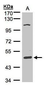 SCARA3 Rabbit Polyclonal Antibody