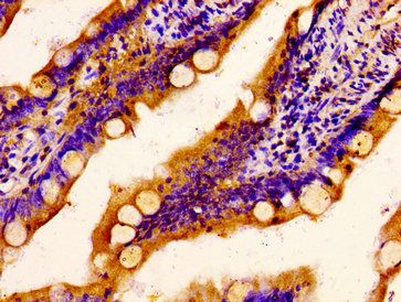 SCARA5 Antibody