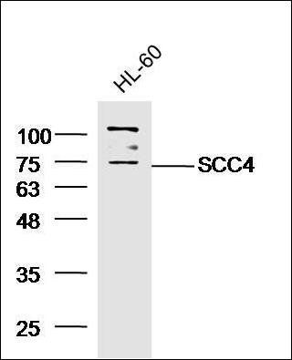 SCC4 Rabbit Polyclonal Antibody