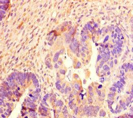 SCG2 antibody