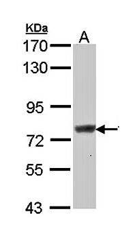 Scinderin antibody