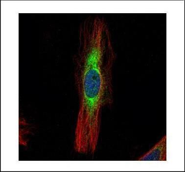 Scinderinderin antibody