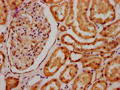 SCLY Antibody