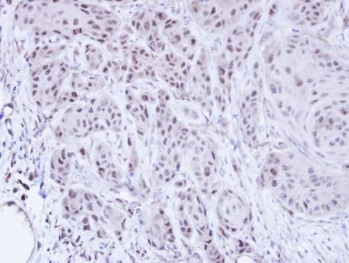 SCMH1 Rabbit Polyclonal Antibody