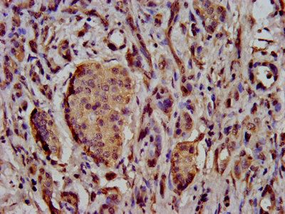 SCN11A Antibody