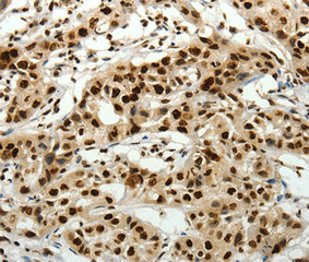 SCN11A antibody