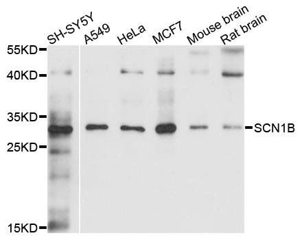 SCN1B antibody