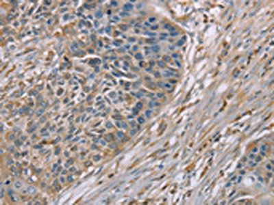 SCN1B Antibody