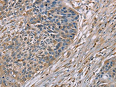 SCN1B antibody