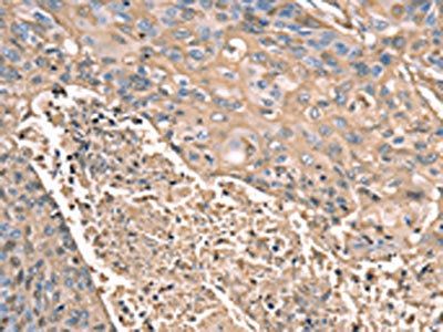 SCN1B Antibody