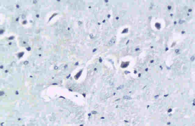 SCN1B Rabbit Polyclonal Antibody