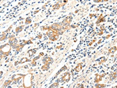 SCN2A Antibody
