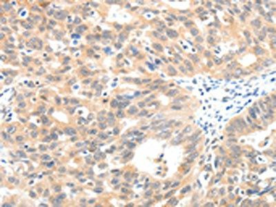 SCN2A Antibody