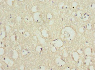 SCN2B Antibody